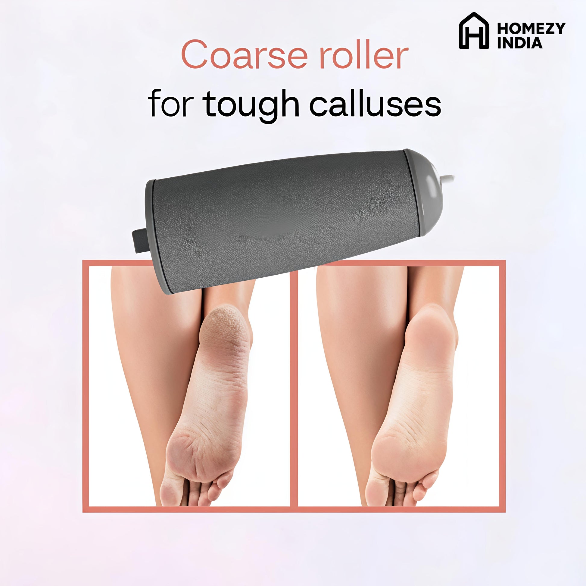 Homezy India's Premium Callus Remover