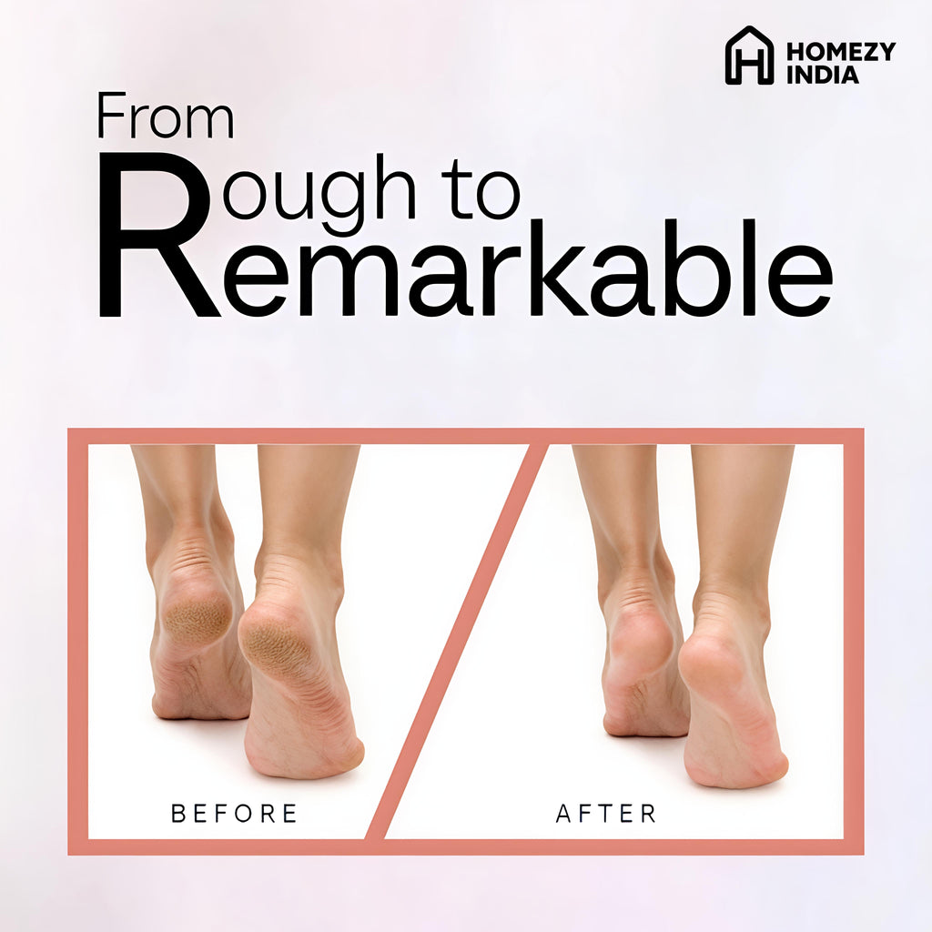 Homezy India's Premium Callus Remover