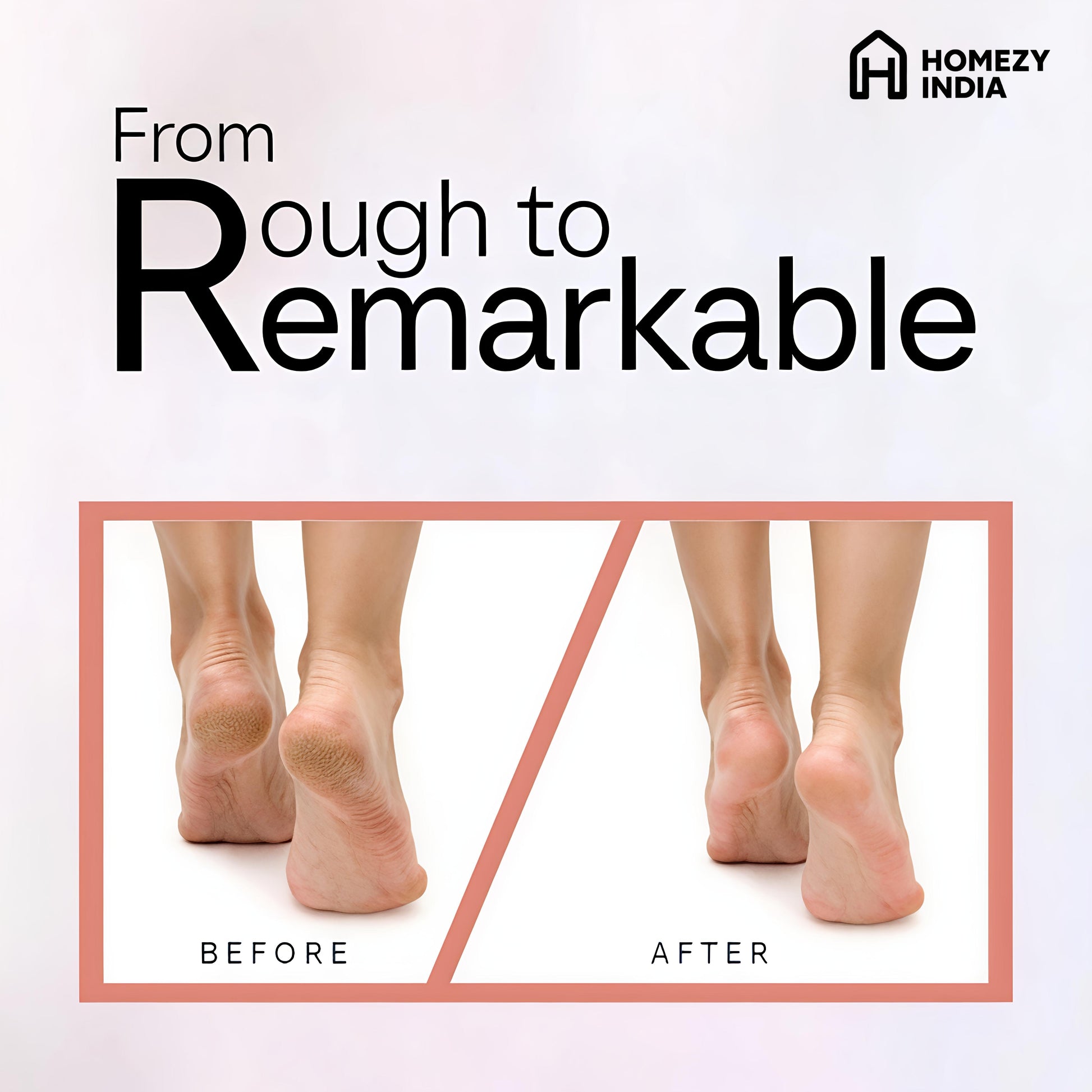 Homezy India's Premium Callus Remover