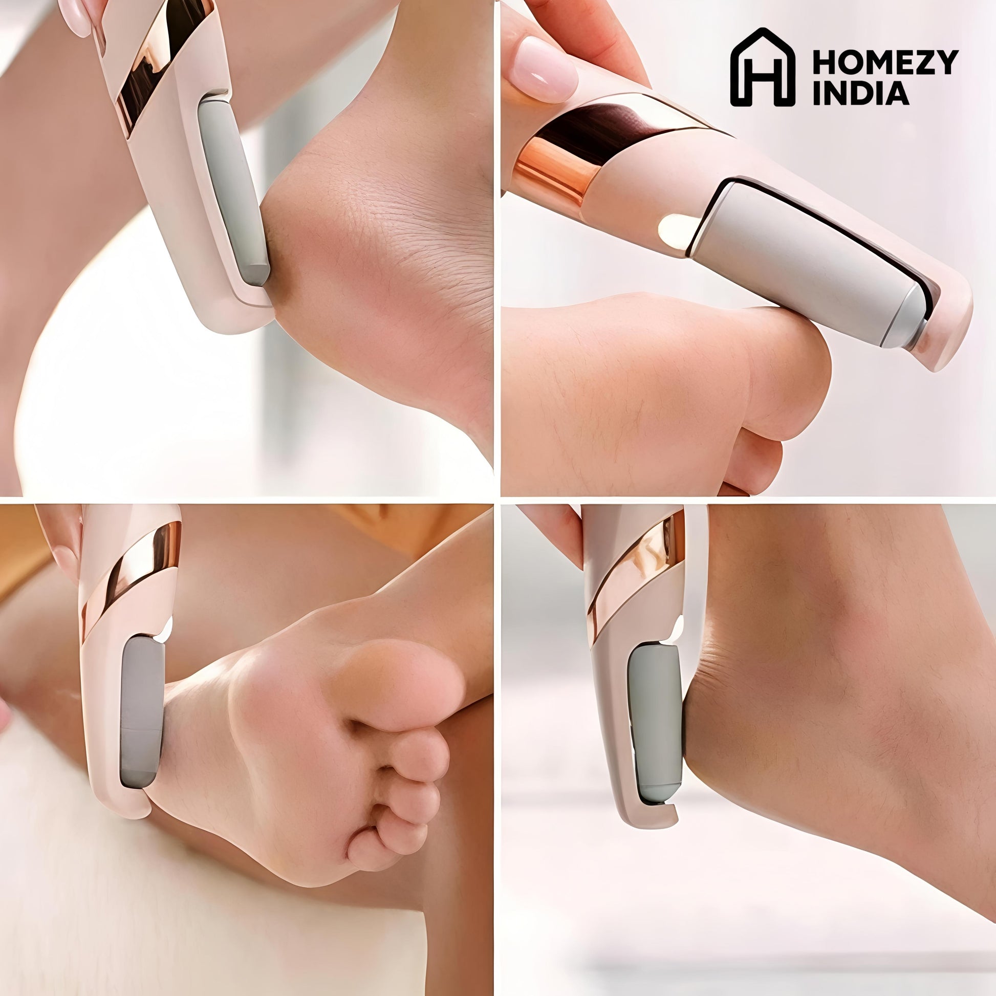Homezy India's Premium Callus Remover